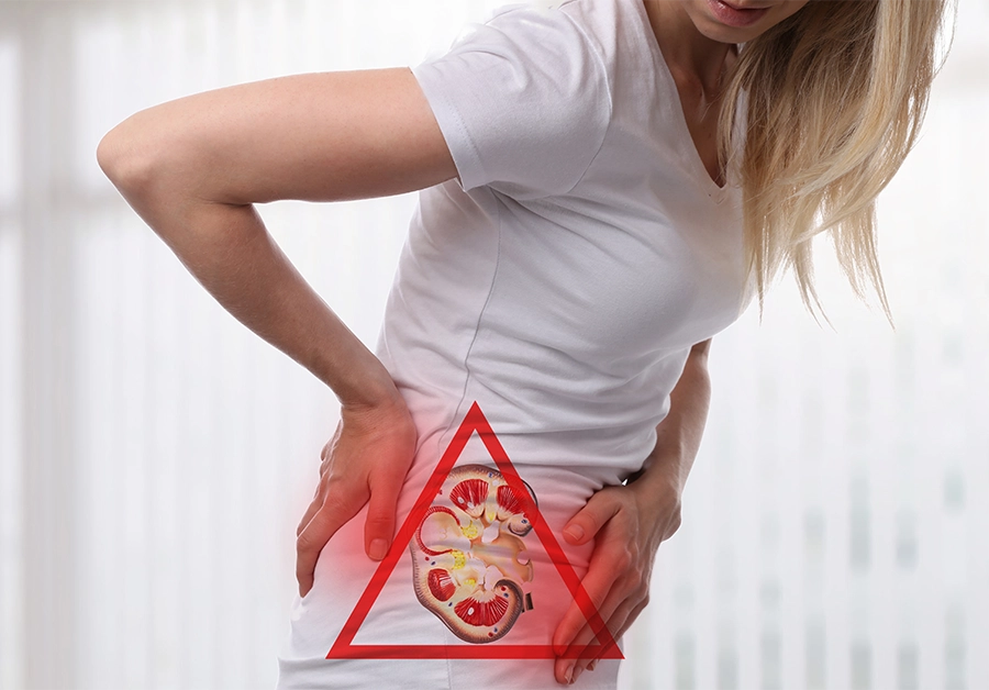 Woman in pain from kidney stones